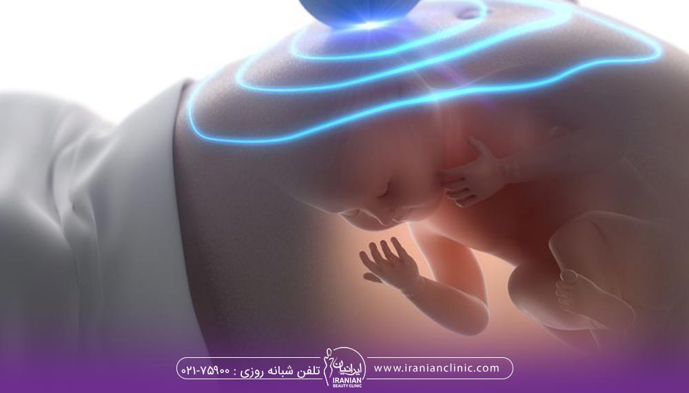 لیزر موهای زائد در زمان بارداری