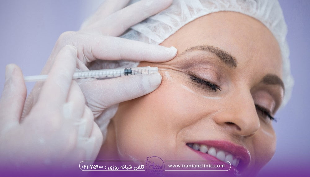 ورم بعد از تزریق مزوژل - تزریق مزوژل برای رفع چین و چروک صورت خانمها