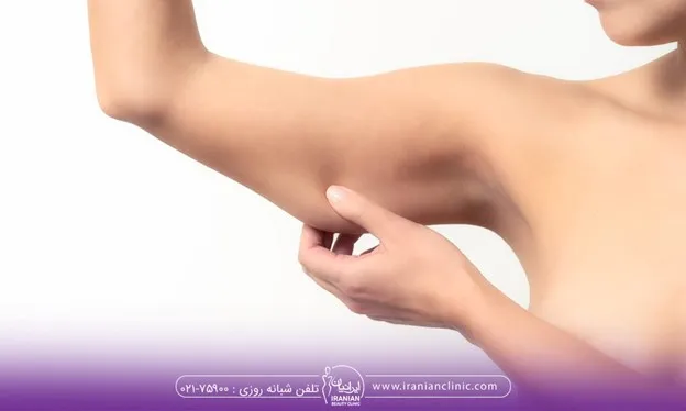 مراقبت های بعد از براکیوپلاستی