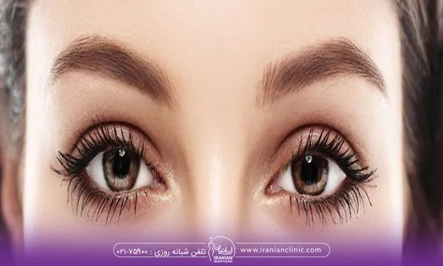 نکات مهم درباره رنگ کردن ابرو بعد از کاشت ابرو