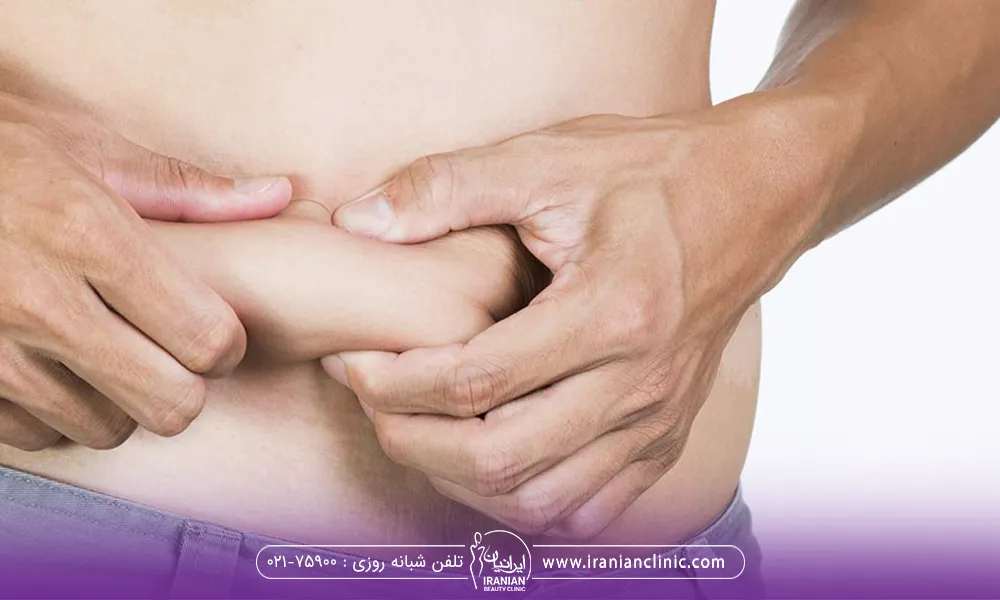 مردی که از چربی شکمش رنج میبرد و با دستانش گرفته است