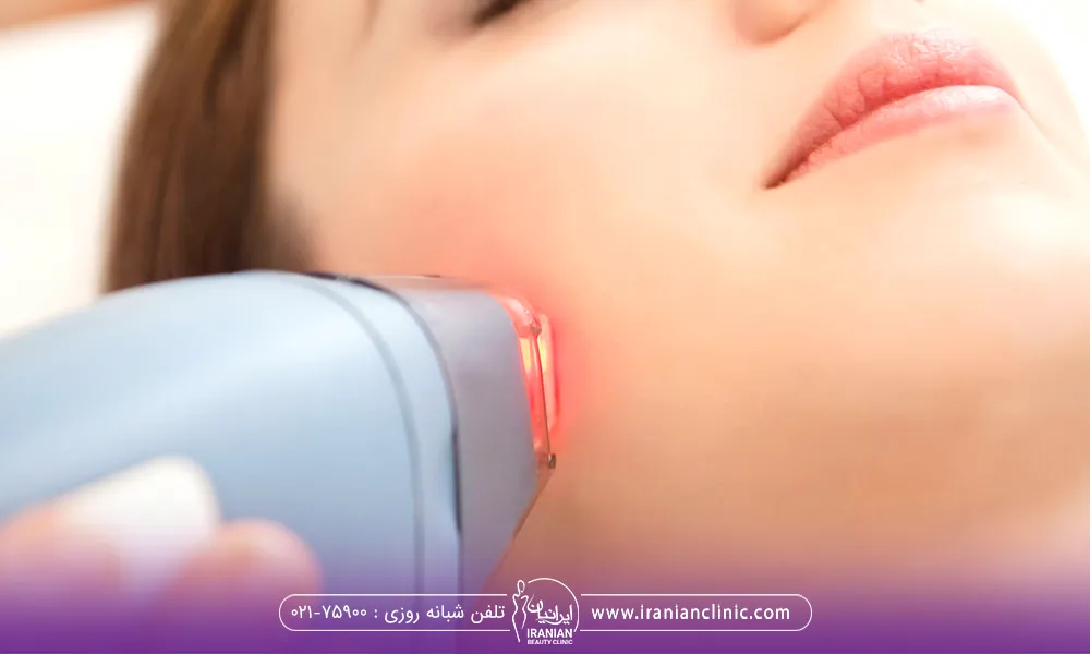 یک اپراتور لیزر که درحال لیزر کردن صورت یک خانم است