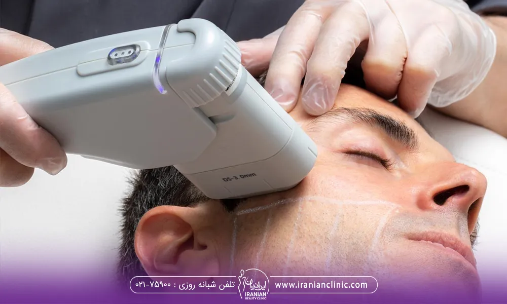 مردی که خوابیده و اپراتور درحال هایفو ترابی برای فرد است