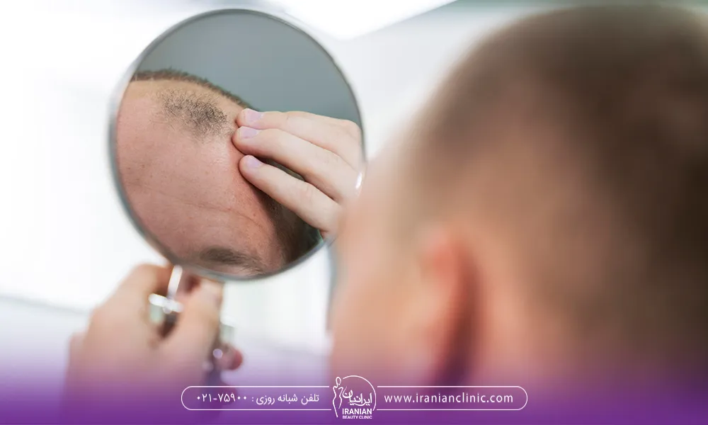 عواملی که باعث ریزش مو می شوند.