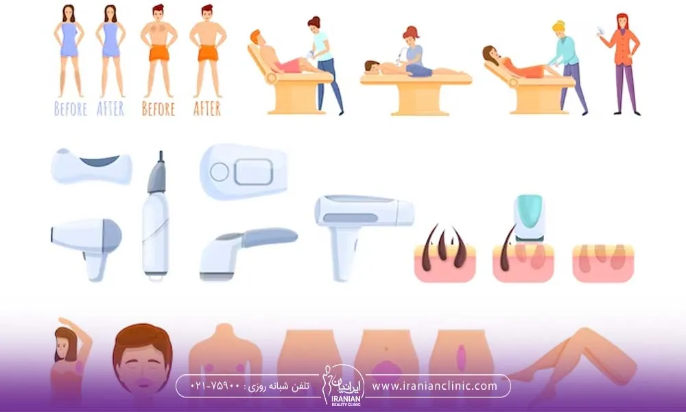 چند نکته قبل از انجام لیزر موهای زائد
