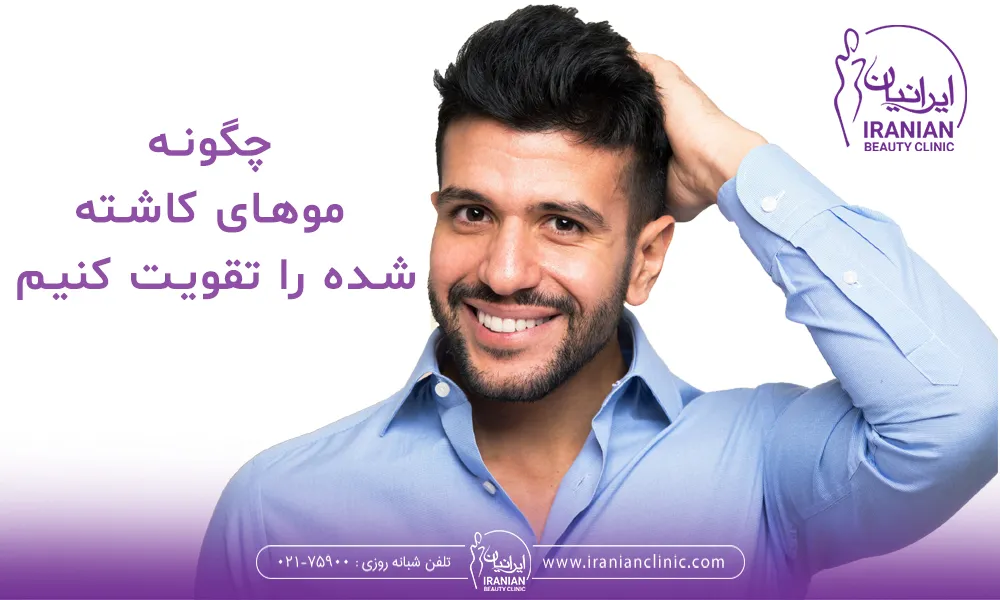راه تقویت موهای کاشته شده