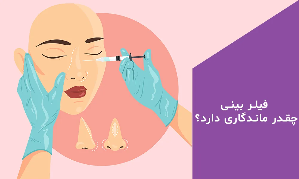 راجب به ماندگاری فیلر بینی اطلاعاتی دارید ؟