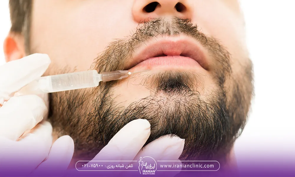 تزریق ژل لب مردانه