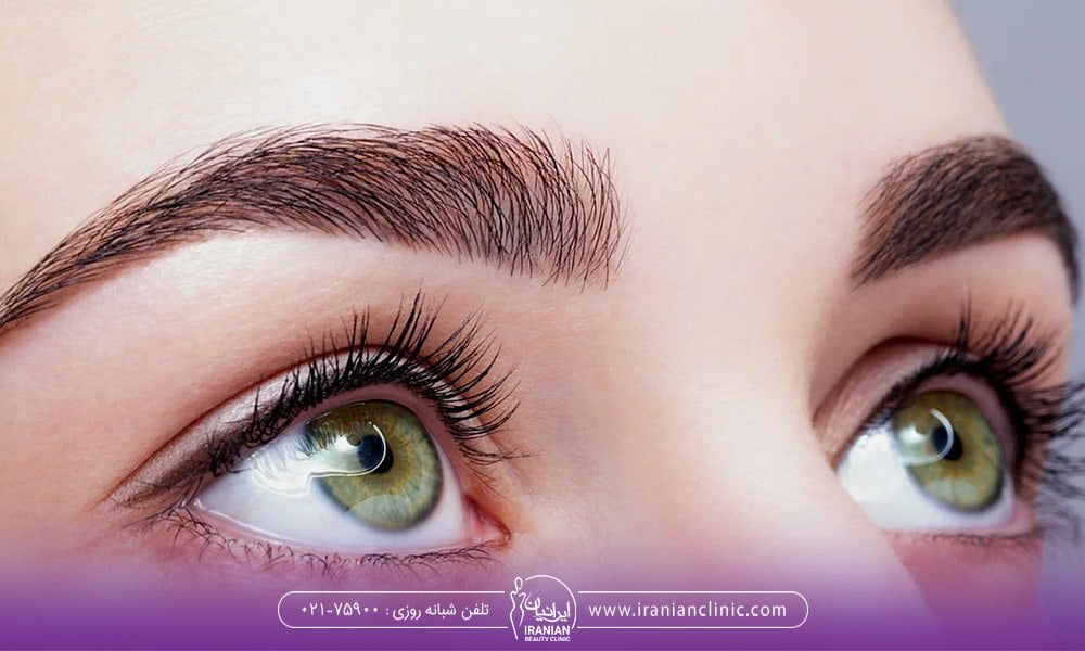 کاشت ابرو دائمی خواهد بود یا خیر ؟