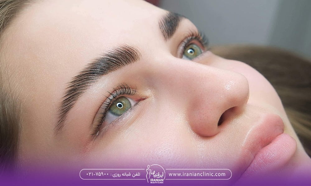 می توانم روی تاتو های ابرو کاشت ابرو انجام بدم ؟