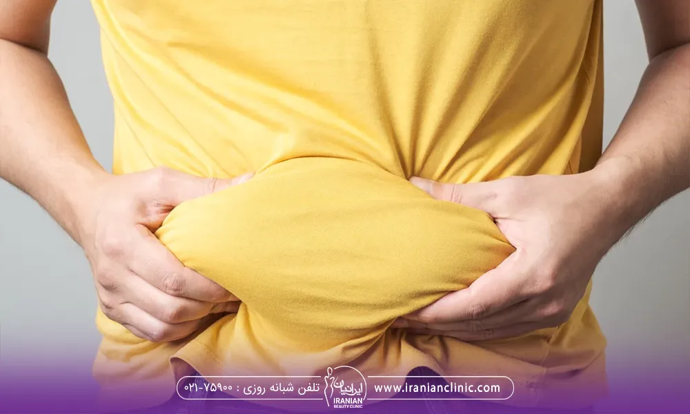 یک آقا که از چاقی شکم خود رنج میبرد