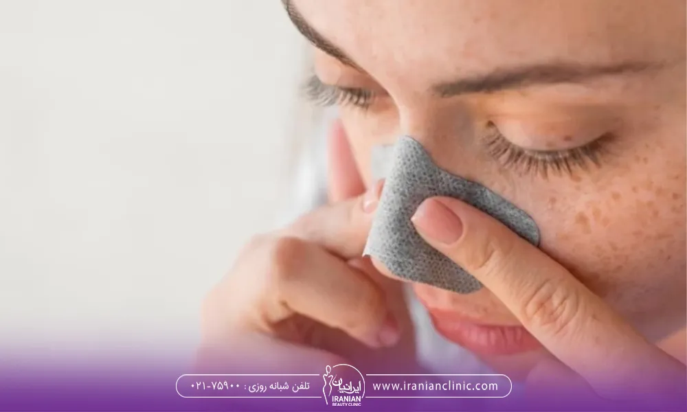 طریقه چسب زدن بینی