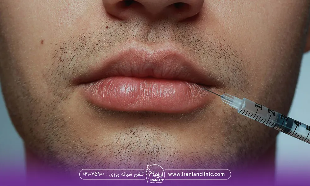 یک آقا که توسط دکتر تزریق ژل به ناحیه لب انجام میدهد