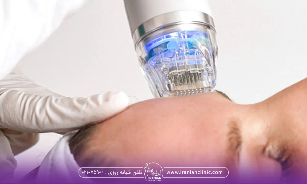 اپراتوری برای یک خانم ار اف فر کشنال انجام میدهد