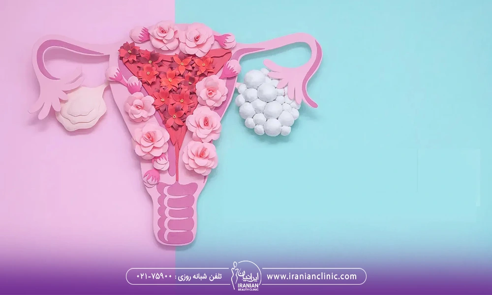 عکس گلهایی که به شکل رحم و تخمدان چیده شده اند با پس زمینه آبی روشن و صورتی