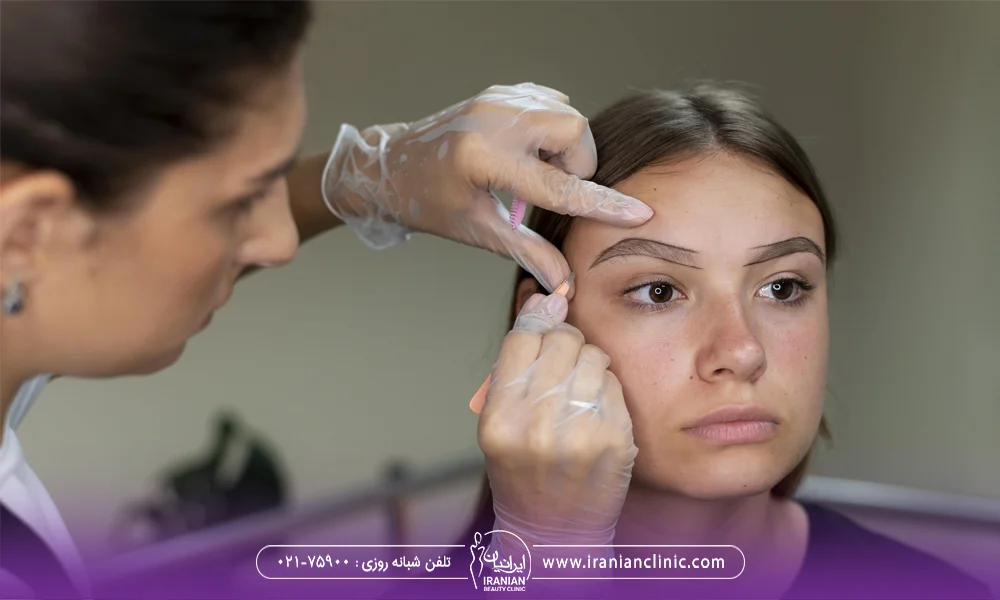 پزشک در حال رسم محل کاشت ابرو روی صورت دختر - بهترین کلینیک کاشت ابرو در تهران