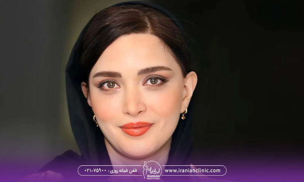 عکس بهنوش طباطبایی با شال مشکی - عمل های زیبایی بهنوش طباطبایی