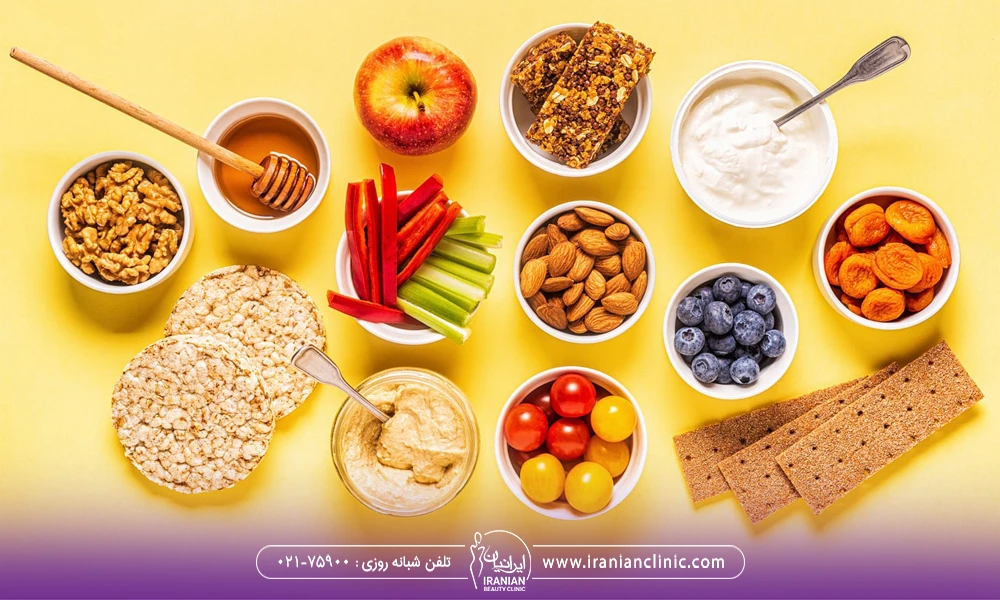 مواد غذایی شامل میوه ها و سبزیجات که روی یک سطح زرد رنگ قرار گرفته اند