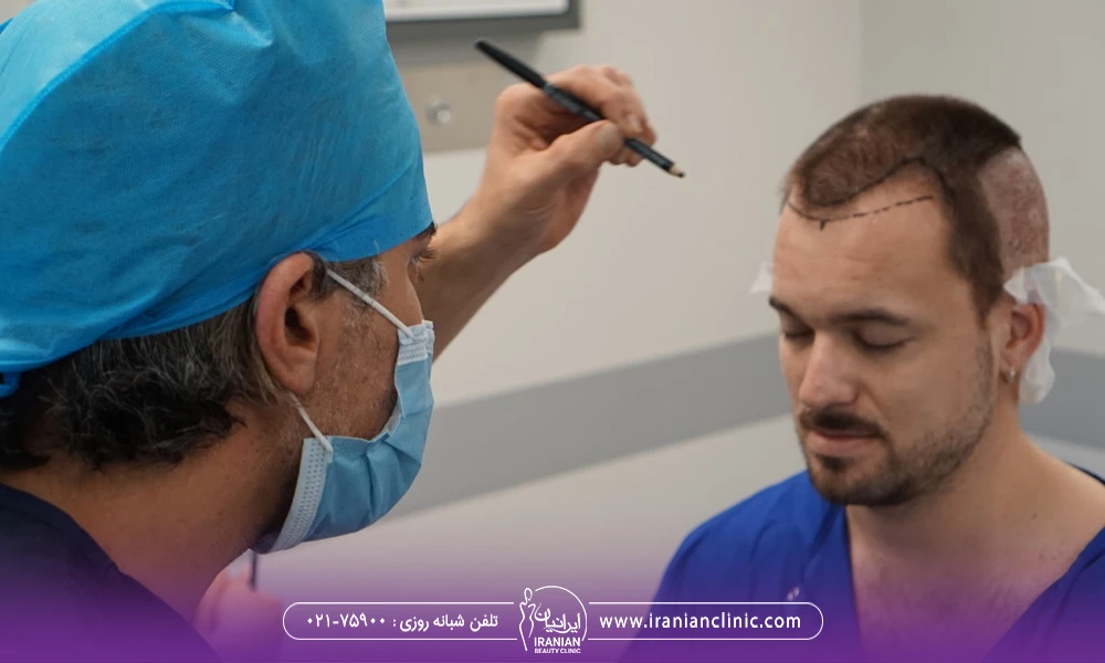 پزشکی که روی سر مرد کاشت مو انجام داده است