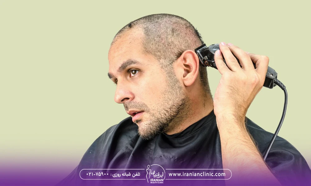 مردی که با ماشین اصلاح سر خود را اصلاح می کند