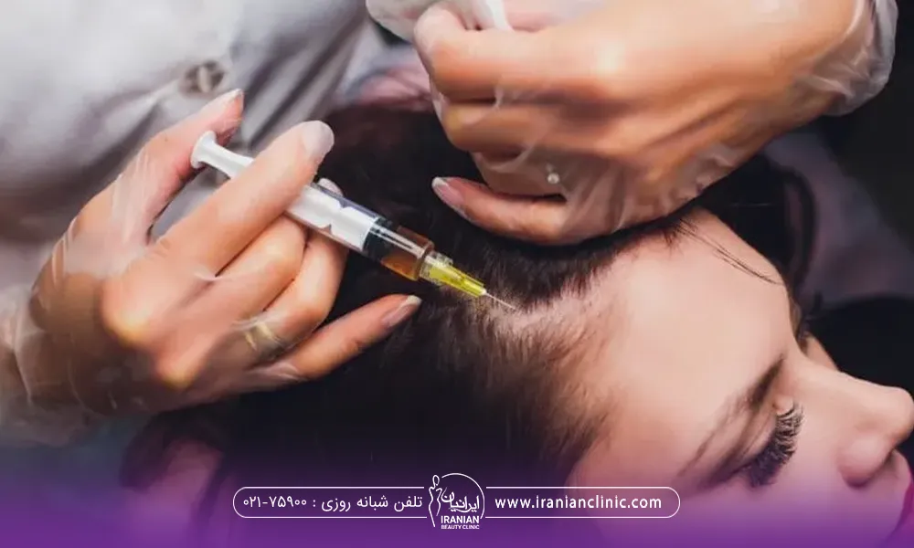 خانمی که نشسته و دستان پزشک که روی سر فرد است که با یک دست موهایش و پد را گرفته و با دست دیگه در حال تزریق است - مراقبت های بعد از تزریق هیر فیلر مو