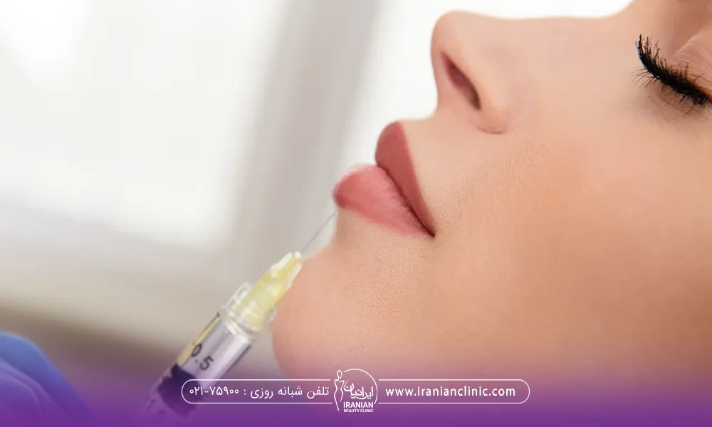 نیمرخ دختری که چشم هایش بسته است و سر سوزن نزدیک لب او است - مراقبت های بعد از تزریق ژل لب