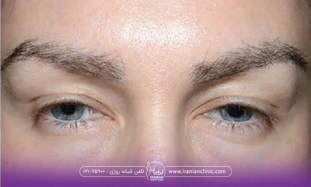 تصویر نزدیک از چشمان یک زن که ابروهای کم پشت و کوتاه دارد