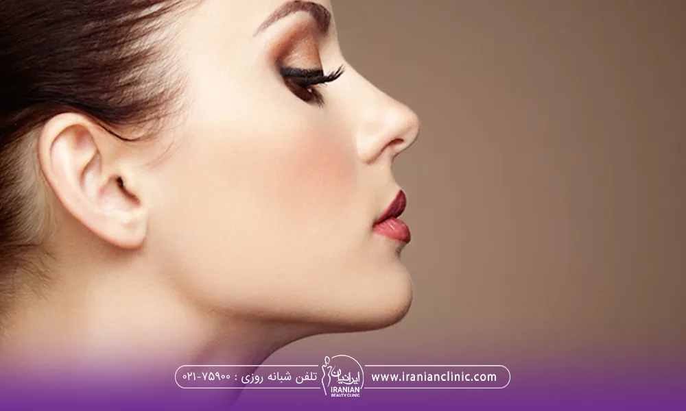نیمرخ خانمی که لیفت بینی با نخ انجام داده است