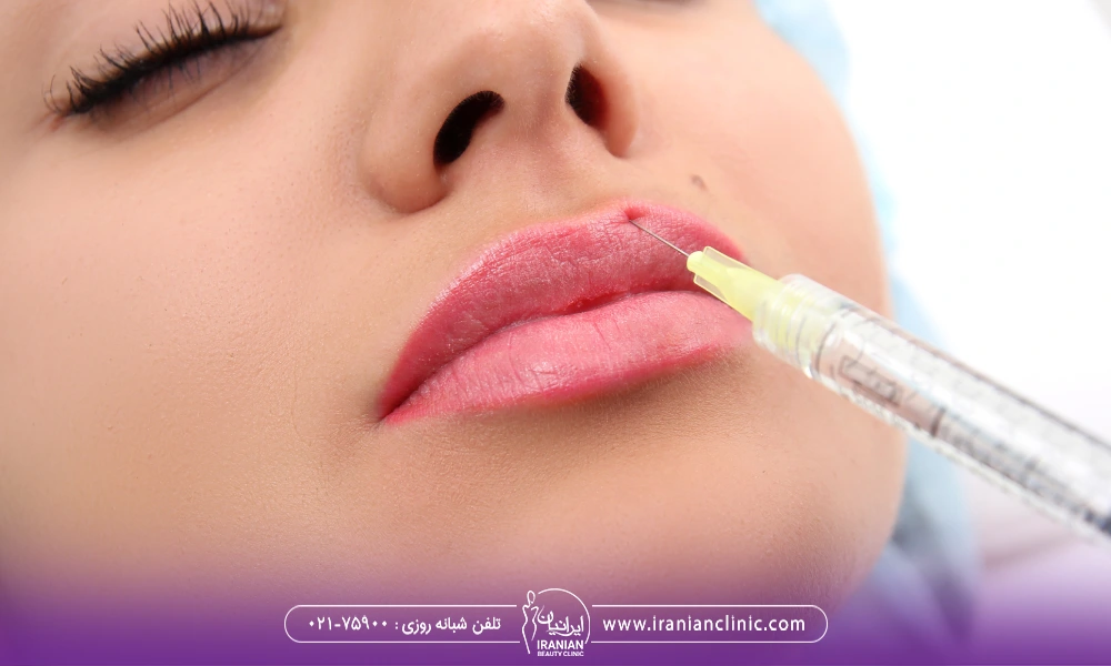 تزریق ژل لب در بارداری