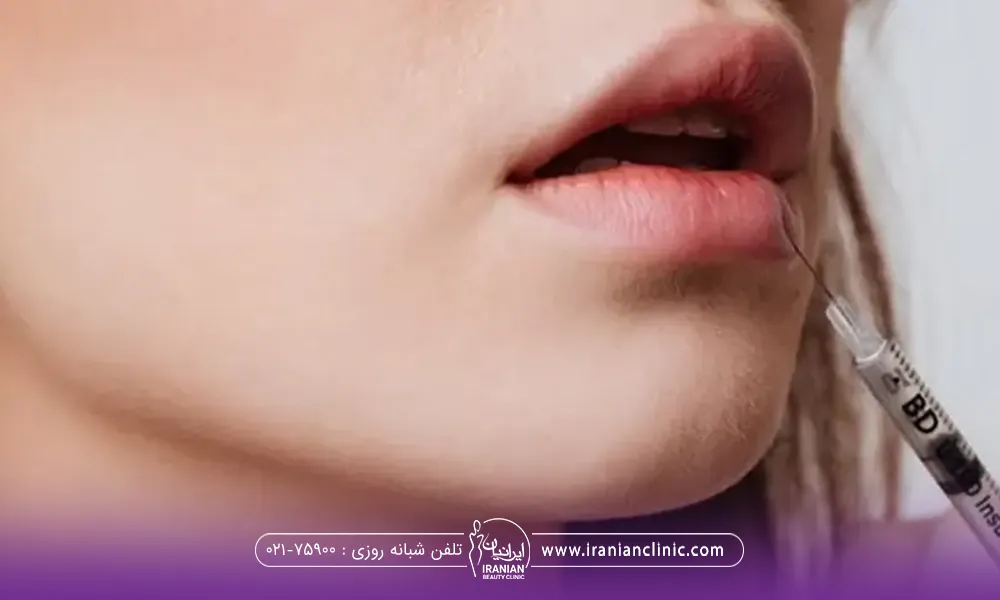 دختری که دهانش را باز کرده و پزشک به لب پایین او ژل تزریق می کند - قیمت تزریق ژل لب