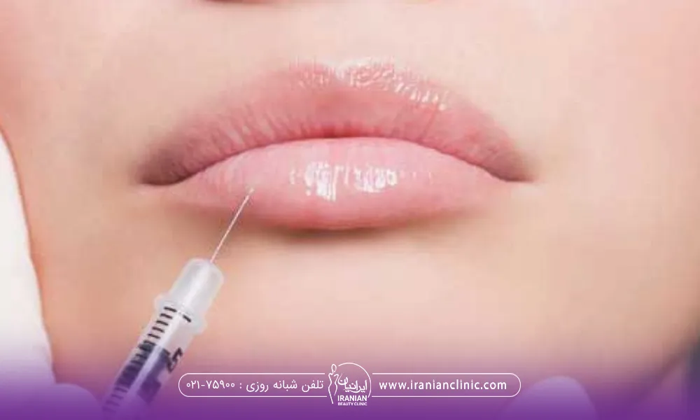 دست دکتری که در حال تزریق فیلر به لب پایین دختر است - عوارض تزریق ژل لب