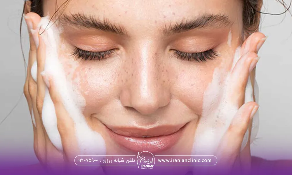 خانم خوشحالی که چشم هایش بسته است و هر دو دست کفی خود را به صورت خود چسبانده و در حال شستن صورت خود است - شستن صورت بعد از تزریق چربی