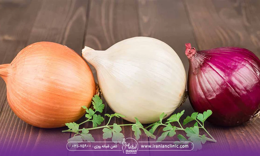 یک پیاز سفید و یک پیاز بنفش و یک پیاز نارنجی - پیاز بعد از کاشت مو​