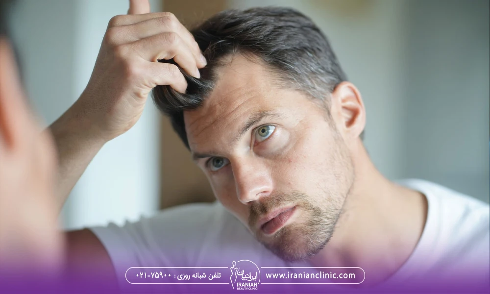 مردی که در آینه به موهای خود نگاه می کند و موهای او در ناحیه شقیقه کمی کم پشت شده است