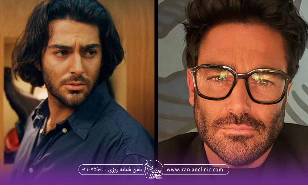 بازیگر محمد رضا گلزار که عمل بوکال فت انجام داده است