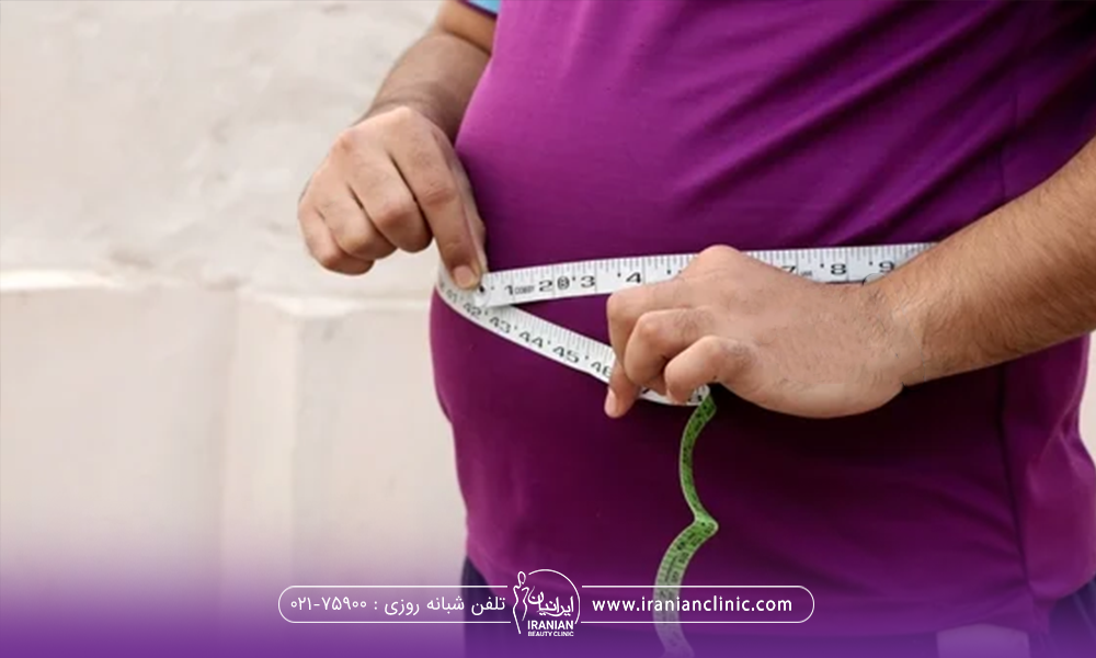 فردی که چاق است و متر را دور شکم خود نگه داشته است - رژیم غذایی بعد بوتاکس معده​