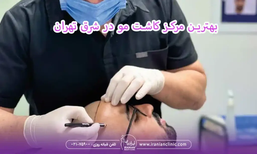  بهترین مرکز کاشت مو در شرق تهران، کلینیک کاشت مو ایرانیان