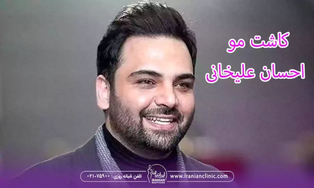 کاشت مو احسان علیخانی