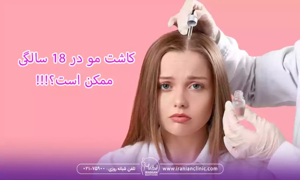 کاشت مو در 18 سالگی