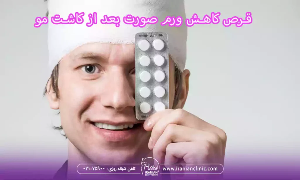 قرص برای کاهش ورم صورت بعد از کاشت مو