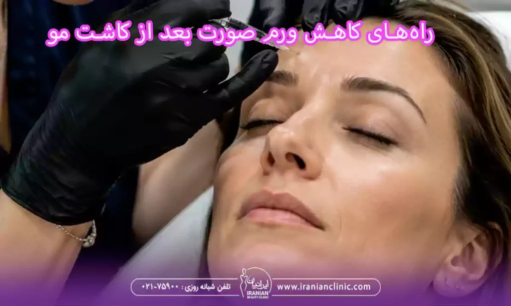 بهترین مرکز تزریق بوتاکس در غرب تهران
